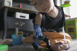 LEGO Prosthetic Arm Empowers 8-Year Old with Affordable Accessible Healthcare